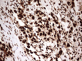 HNRNPM Antibody in Immunohistochemistry (Paraffin) (IHC (P))