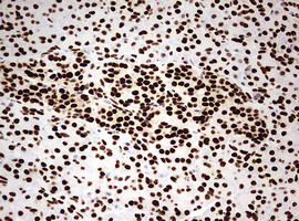 HNRNPM Antibody in Immunohistochemistry (Paraffin) (IHC (P))