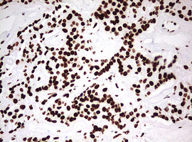 HNRNPM Antibody in Immunohistochemistry (Paraffin) (IHC (P))