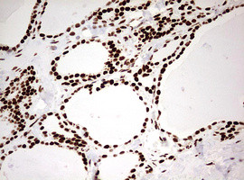 HNRNPM Antibody in Immunohistochemistry (Paraffin) (IHC (P))