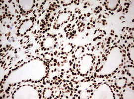 HNRNPM Antibody in Immunohistochemistry (Paraffin) (IHC (P))