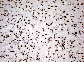 HNRNPM Antibody in Immunohistochemistry (Paraffin) (IHC (P))