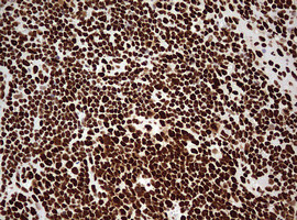 HNRNPM Antibody in Immunohistochemistry (Paraffin) (IHC (P))