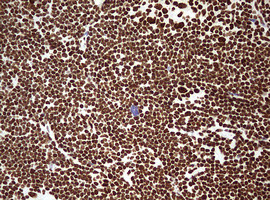 HNRNPM Antibody in Immunohistochemistry (Paraffin) (IHC (P))