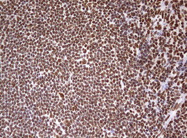 HNRNPM Antibody in Immunohistochemistry (Paraffin) (IHC (P))