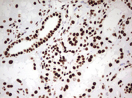 HNRNPM Antibody in Immunohistochemistry (Paraffin) (IHC (P))