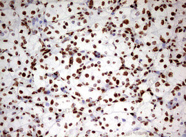 HNRNPM Antibody in Immunohistochemistry (Paraffin) (IHC (P))