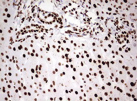 HNRNPM Antibody in Immunohistochemistry (Paraffin) (IHC (P))