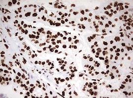 HNRNPM Antibody in Immunohistochemistry (Paraffin) (IHC (P))