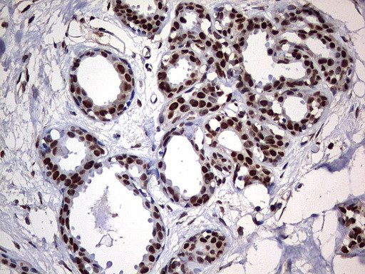 HNRNPM Antibody in Immunohistochemistry (Paraffin) (IHC (P))