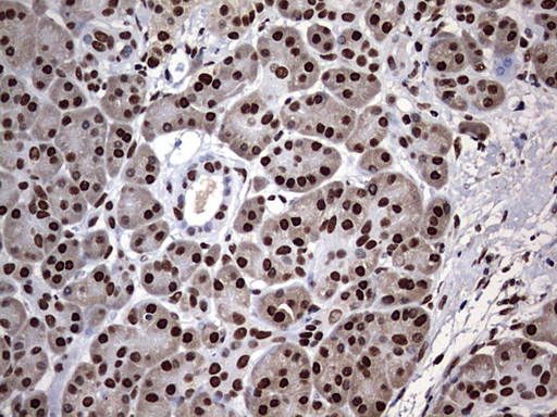 HNRNPM Antibody in Immunohistochemistry (Paraffin) (IHC (P))