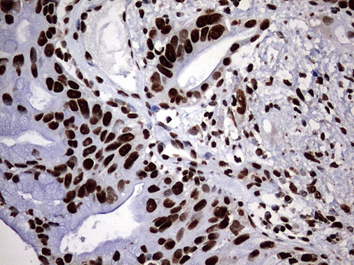 HNRNPM Antibody in Immunohistochemistry (Paraffin) (IHC (P))