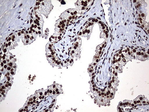 HNRNPM Antibody in Immunohistochemistry (Paraffin) (IHC (P))