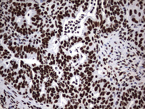 HNRNPM Antibody in Immunohistochemistry (Paraffin) (IHC (P))