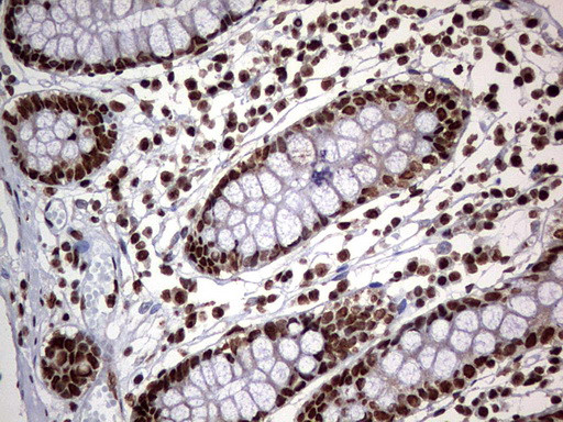 HNRNPM Antibody in Immunohistochemistry (Paraffin) (IHC (P))