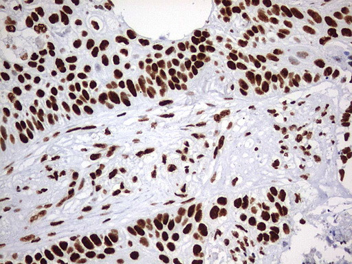 HNRNPM Antibody in Immunohistochemistry (Paraffin) (IHC (P))