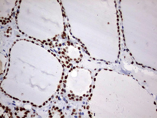 HNRNPM Antibody in Immunohistochemistry (Paraffin) (IHC (P))