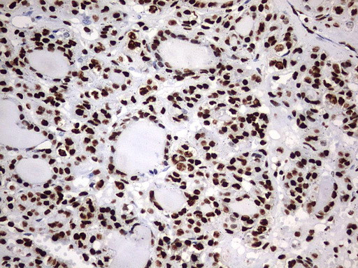 HNRNPM Antibody in Immunohistochemistry (Paraffin) (IHC (P))