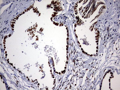 HNRNPM Antibody in Immunohistochemistry (Paraffin) (IHC (P))