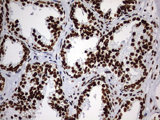 HNRNPM Antibody in Immunohistochemistry (Paraffin) (IHC (P))