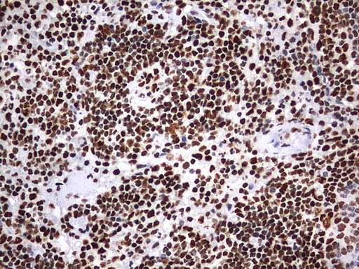 HNRNPM Antibody in Immunohistochemistry (Paraffin) (IHC (P))