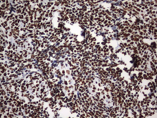 HNRNPM Antibody in Immunohistochemistry (Paraffin) (IHC (P))