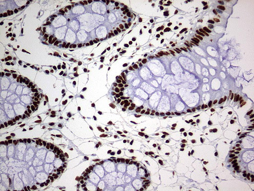 HNRNPM Antibody in Immunohistochemistry (Paraffin) (IHC (P))