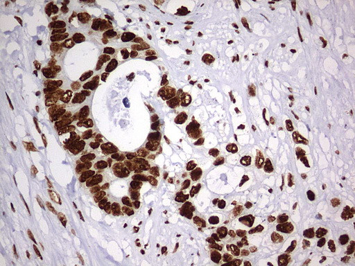 HNRNPM Antibody in Immunohistochemistry (Paraffin) (IHC (P))