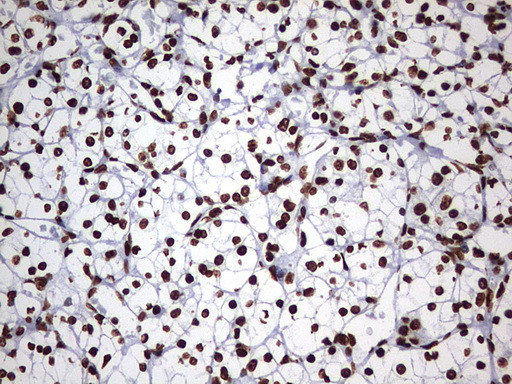 HNRNPM Antibody in Immunohistochemistry (Paraffin) (IHC (P))