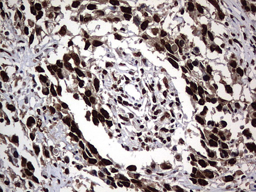 HNRNPM Antibody in Immunohistochemistry (Paraffin) (IHC (P))