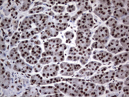 HNRNPM Antibody in Immunohistochemistry (Paraffin) (IHC (P))