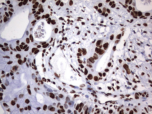 HNRNPM Antibody in Immunohistochemistry (Paraffin) (IHC (P))