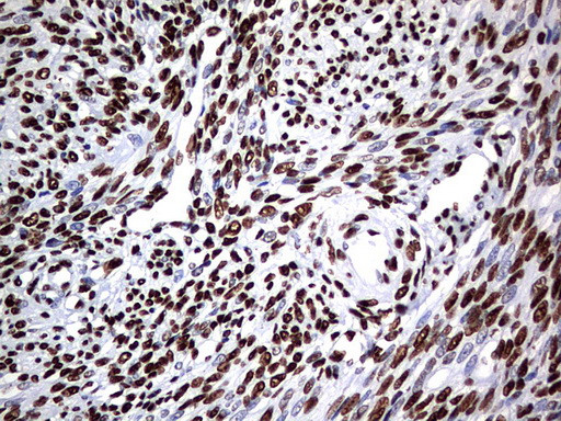 HNRNPM Antibody in Immunohistochemistry (Paraffin) (IHC (P))