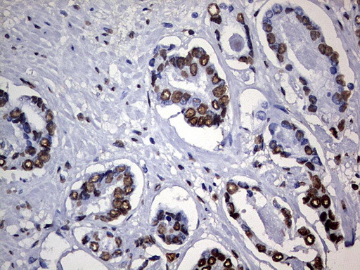 HNRNPM Antibody in Immunohistochemistry (Paraffin) (IHC (P))