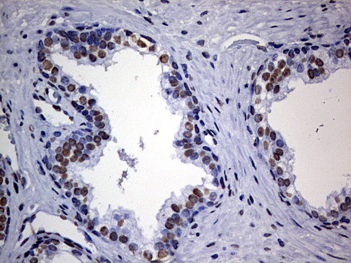 HNRNPM Antibody in Immunohistochemistry (Paraffin) (IHC (P))