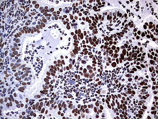 HNRNPM Antibody in Immunohistochemistry (Paraffin) (IHC (P))