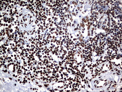 HNRNPM Antibody in Immunohistochemistry (Paraffin) (IHC (P))