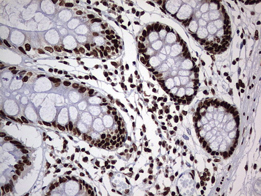 HNRNPM Antibody in Immunohistochemistry (Paraffin) (IHC (P))