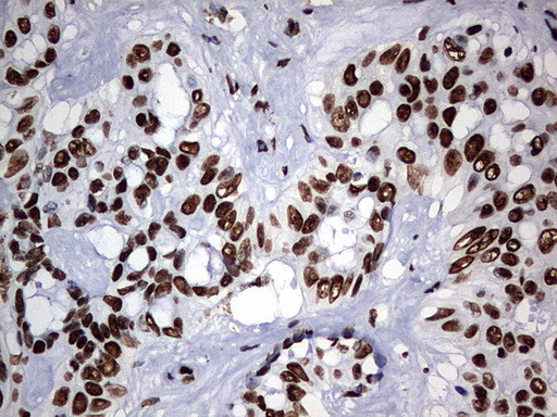 HNRNPM Antibody in Immunohistochemistry (Paraffin) (IHC (P))