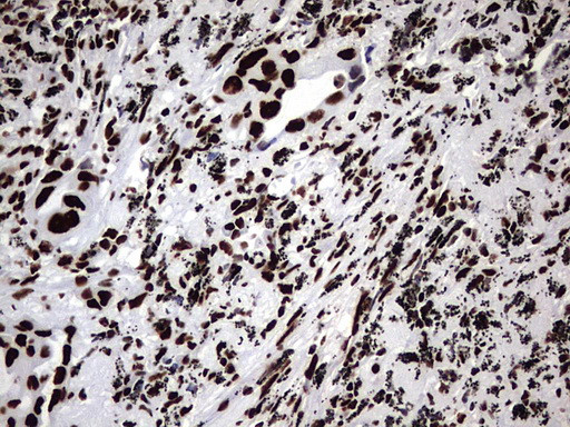 HNRNPM Antibody in Immunohistochemistry (Paraffin) (IHC (P))