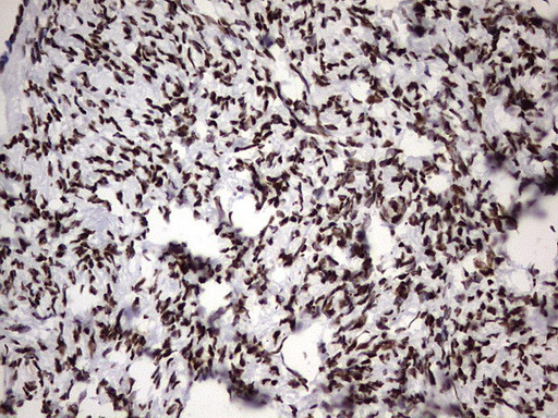 HNRNPM Antibody in Immunohistochemistry (Paraffin) (IHC (P))