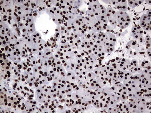 HNRNPM Antibody in Immunohistochemistry (Paraffin) (IHC (P))