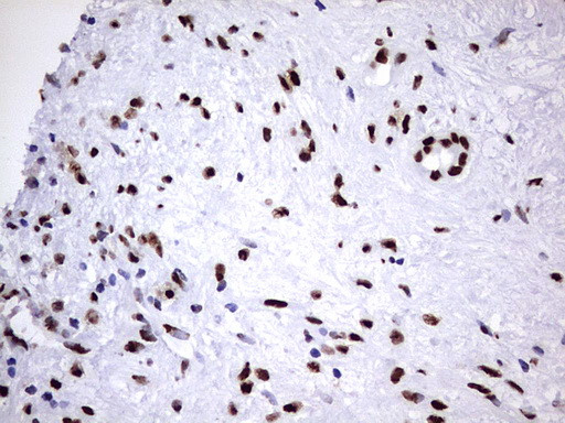 HNRNPM Antibody in Immunohistochemistry (Paraffin) (IHC (P))