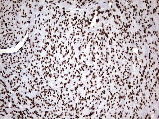 HNRNPM Antibody in Immunohistochemistry (Paraffin) (IHC (P))