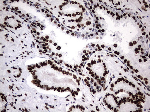 HNRNPM Antibody in Immunohistochemistry (Paraffin) (IHC (P))