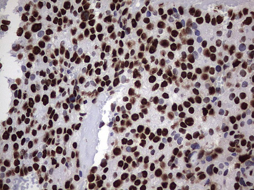 HNRNPM Antibody in Immunohistochemistry (Paraffin) (IHC (P))