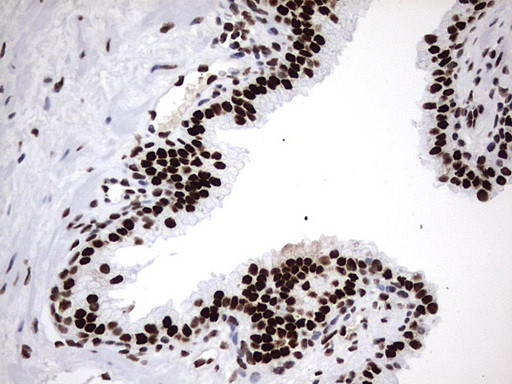 HNRNPM Antibody in Immunohistochemistry (Paraffin) (IHC (P))