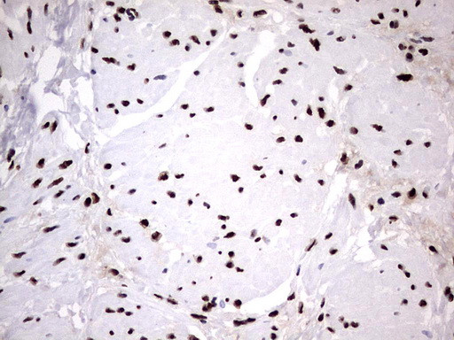 HNRNPM Antibody in Immunohistochemistry (Paraffin) (IHC (P))