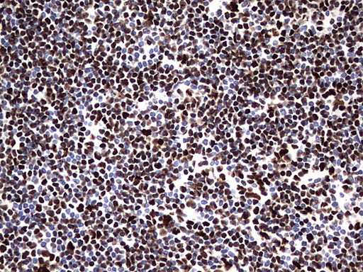 HNRNPM Antibody in Immunohistochemistry (Paraffin) (IHC (P))