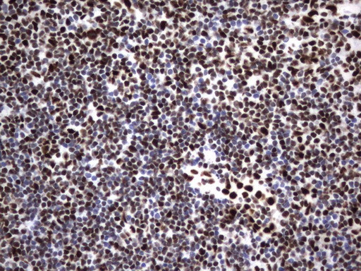 HNRNPM Antibody in Immunohistochemistry (Paraffin) (IHC (P))